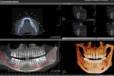 2D Dental Görüntüleme (Panoromik-Sefalometri)